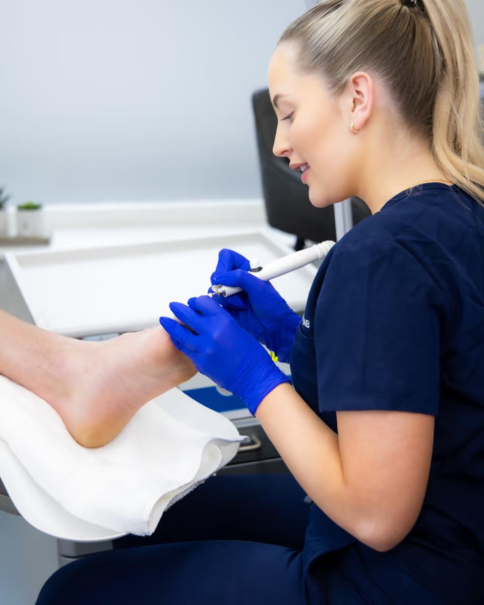 Fungal Nail Treatment — The Foot Lab podiatry clinic, Glossop, North West