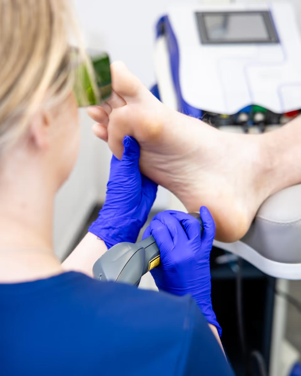 Laser Therapy — The Foot Lab podiatry clinic, Glossop, North West