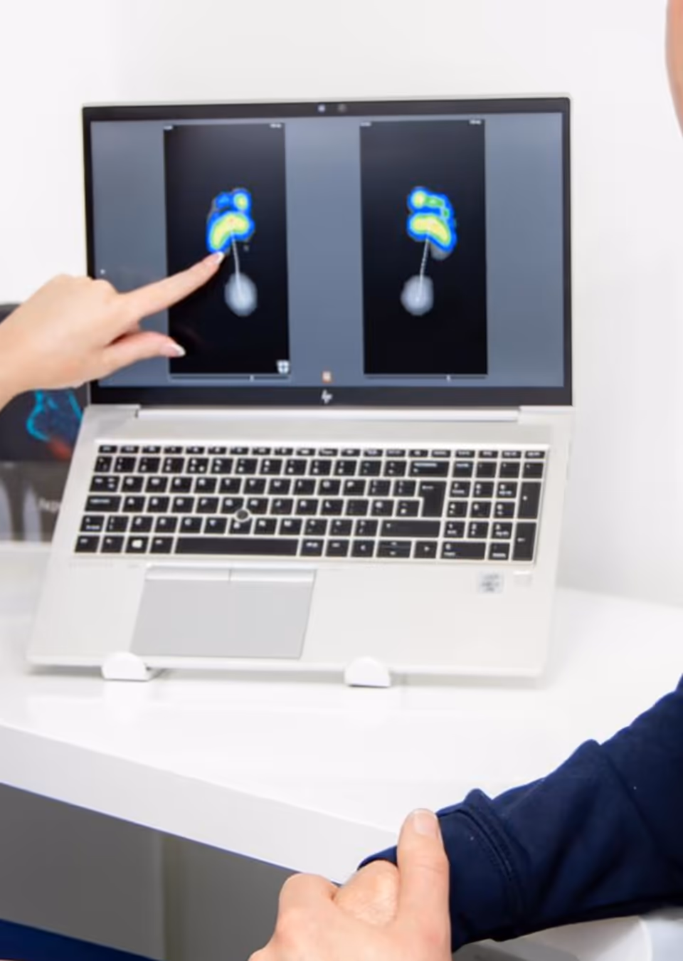 Pressure Plate Gait Analysis — The Foot Lab podiatry clinic, Glossop, North West